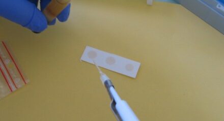 Un nouvel au cas d’hantavirus détecté chez un patient cayennais